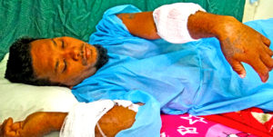 Tobal, Aur fisherman Romie Carland, survived a shark attack last weekend. He’s shown here recovering in Majuro hospital following a medical evacuation on Air Marshall Islands. Photo: Hilary Hosia.